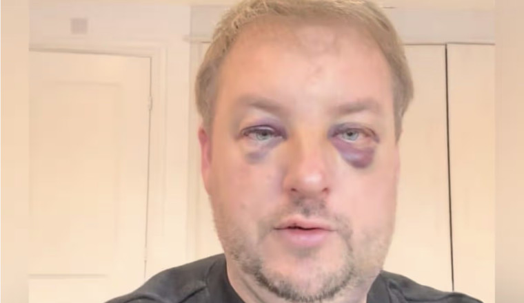Car dealership owner beaten black and blue in 'unprovoked' showroom attack