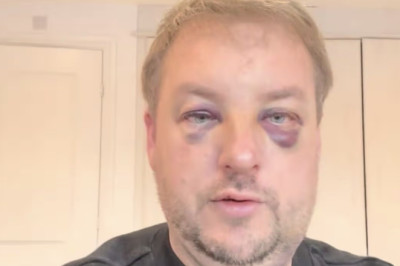Car dealership owner beaten black and blue in 'unprovoked' showroom attack