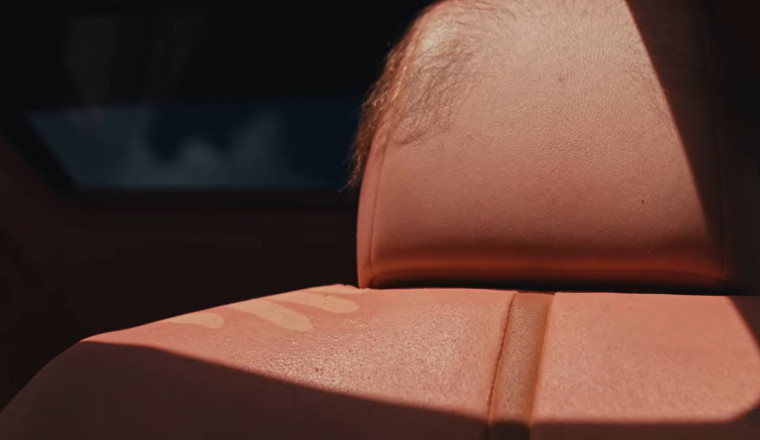 Australian Company Sheds Light On In-Car Sun Exposure By Reupholstering A Camry With Human-Like Skin That 'Burns' In Sunlight